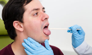 Las muestras de saliva en el laboratorio