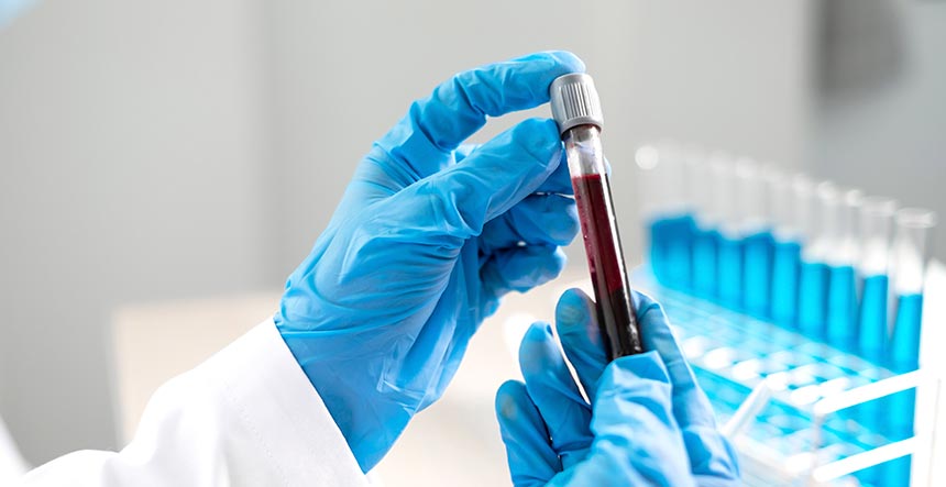 Curso de toma de muestras de laboratorio