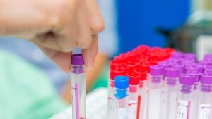 Curso de tomas de muestras